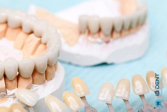 Несъемные протезы зубов в клинике ID Dent
