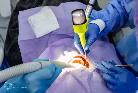 Проф.чистка зубів у стоматологічному кріслі