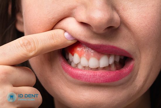 Внешние симптомы наличия гранулемы зуба